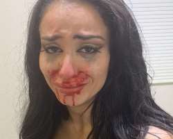 Aliyah (wrestler) before surgery